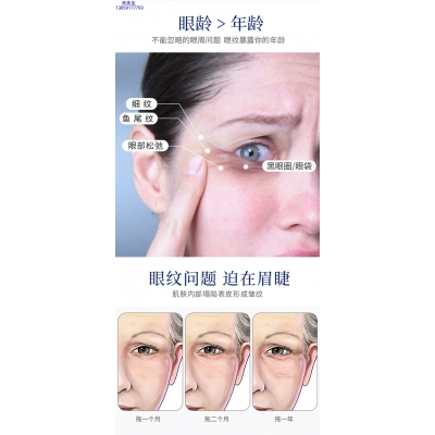 广州壹美生物_美容院玻尿酸微针眼贴